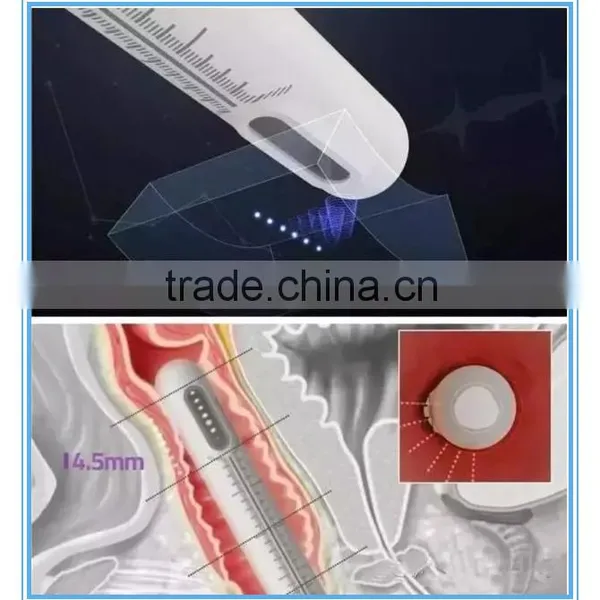 1.0-10mm 2016 Hot Selling Ultrasonic Hifu Vaginal Tightening Machine Skin Tightening photo-4
