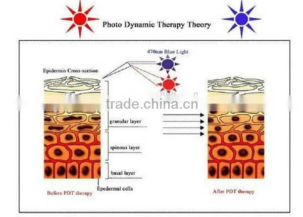 Wrinkle Removal Best Choice Face LED PDT Led Pdt Bio-light Anti-aging Therapy 7 Color Lights Pdt Machine In Usa Spot Removal photo-2
