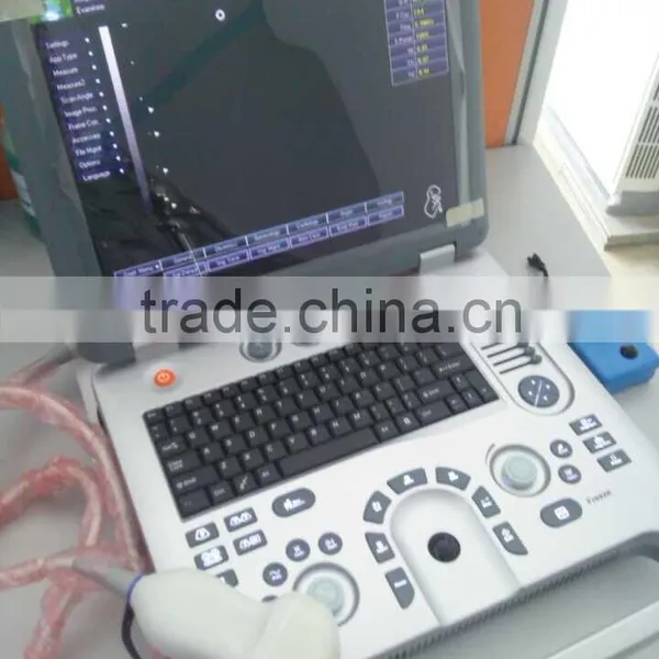 Ultrasound Machine ,ultrasound Machine Price,ultrasound Scanner photo-2