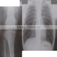 Hot Selling Fuji Agfa Konida Dry Film X-ray Film Thermal Film photo-6
