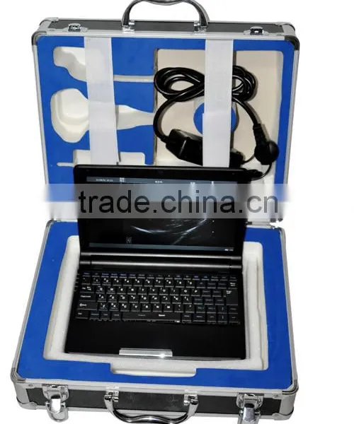 Low Factory Price!CE Approved Laptop Ultrasound Scanner RUS-9000F With 3.5Mhz Convex Probe photo-2