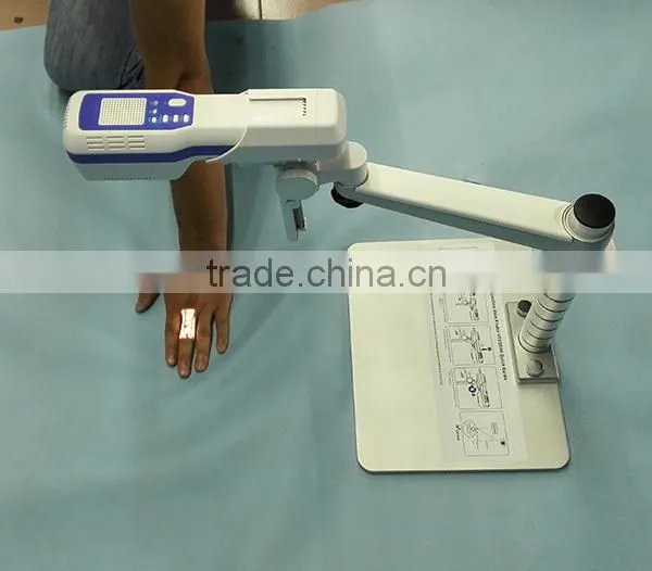 Good Price Easy Operate Medical Injection Portable Projection Vein Finder photo-4