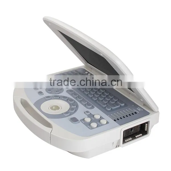 CE & ISO Full Digital Portable Ultrasound Machine Cheap Price PC Ultrasound Scanner for Human photo-6