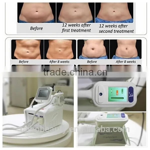 Whole Sale Freeze Sculptor Fat Freezing Cryolipolisis Slimming Fat Removal Weight Loss Machine photo-6