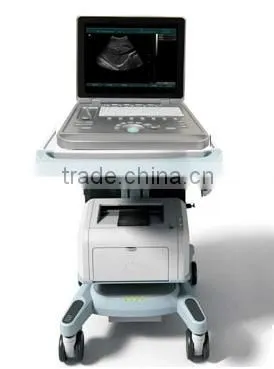 Sonostar Hospital Veterinary Equipment B Model Ultrasound Machine for Sale V9 photo-5