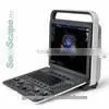 pc Based Ultrasound Scanner Portable Ultrasound Scanner Usb Ultrasound Scanner photo-3
