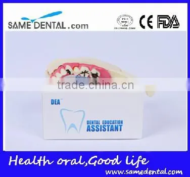 Hemi Mandible Anatomical Model Dental Eduction Assitant No. DEA-18 photo-4