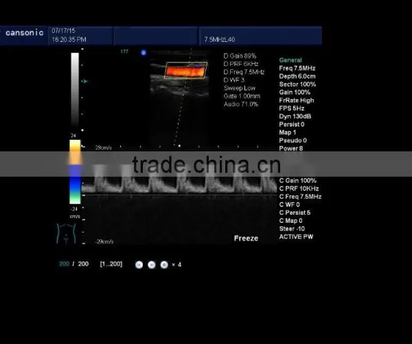 Portable Doppler Ultrasound Machine Color Doppler K10 photo-3
