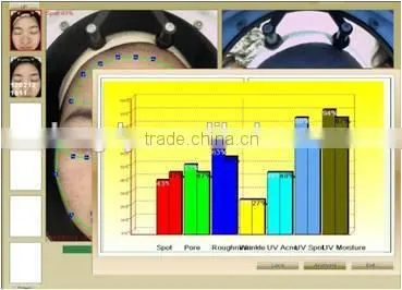 Professional Skin Analyzer / Amazing Magic Mirror for Skin Test photo-4