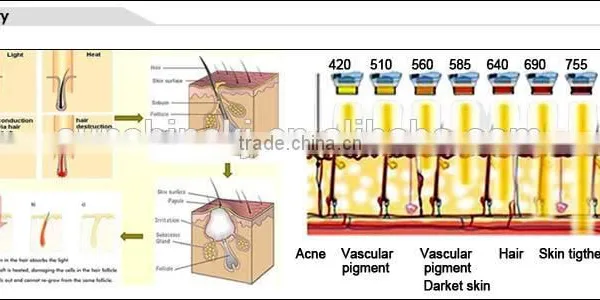 Painless Hair Removal and Acne Removal at Home Portable Machine for Sale photo-2