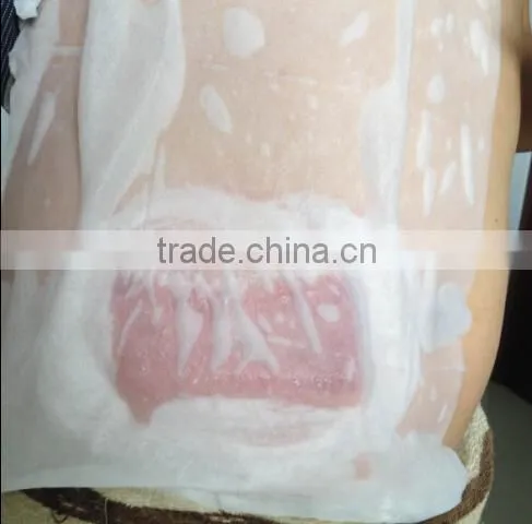 Antifreeze Membrane for Cold Lipolysis photo-5