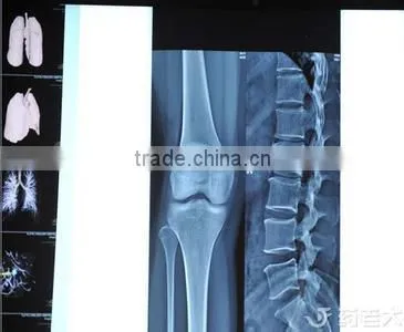 Konida X-ray Medical Film Processor