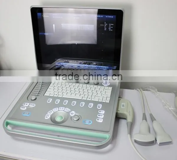 3D 4D Portable Color Doppler Ultrasound Machine C5 photo-3