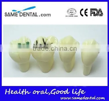Pit and Fissure Model Dental Eduction Assistant No. DEA-19 photo-3