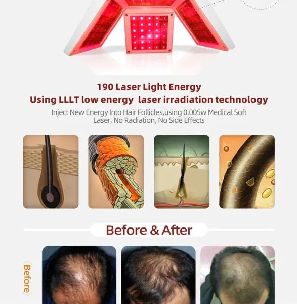 650nm 5mW 48-Diode Laser Cap for Scalp Treatment Hair Growth With 20-Min Auto Shutdown and USB Recharge photo-4