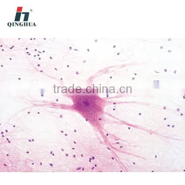 Slide 4261 motor neuron.w.m.