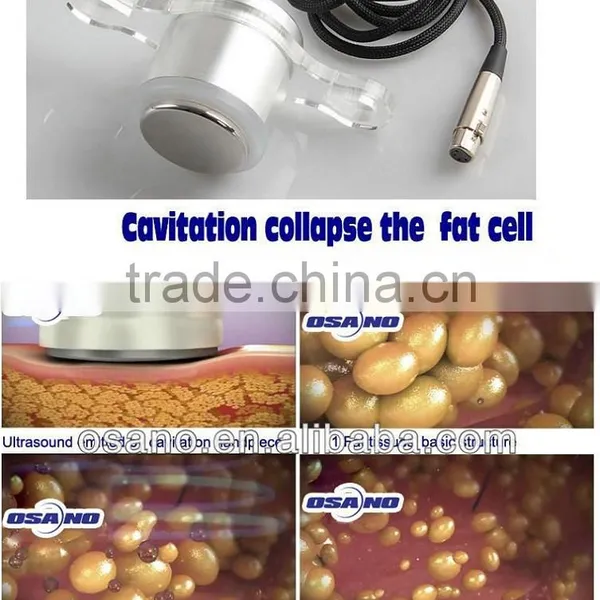 Cryo Lipolysis Machine With Body Contouring Cavitation Radio Frequency Rf Liposuction Cavitation Slimming Machine photo-5