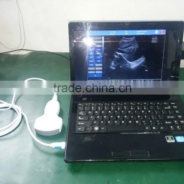 USB Probe B Ultrasound Scanner Integrates Ultrasound Scanner photo-5