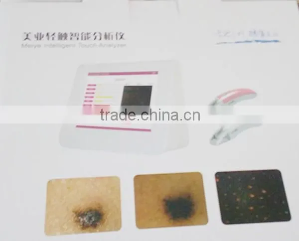 Skin Scanner uv Analysis Machine Factory China POP IPL photo-3