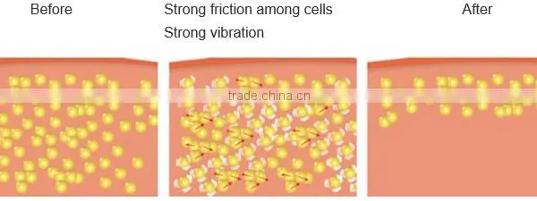 5 in 1 Ultrasonic Cavitation Machine Shockwave Therapy Machine photo-5