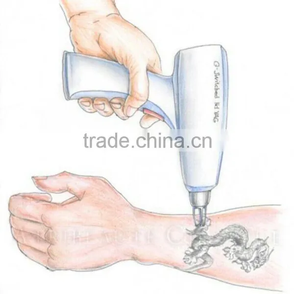 Nd Yag Laser Machine Good Price!! Beauty Device Naevus Of Ito Removal Tattoo Remove Laser Machine Tattoo Removal Laser Equipment photo-6