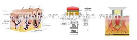 Multifunction Radio Frequency Face Lift Machine photo-6
