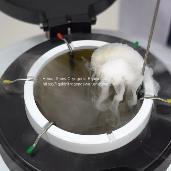 Semen Cryogenic Liquid Nitrogen Bottle photo-4