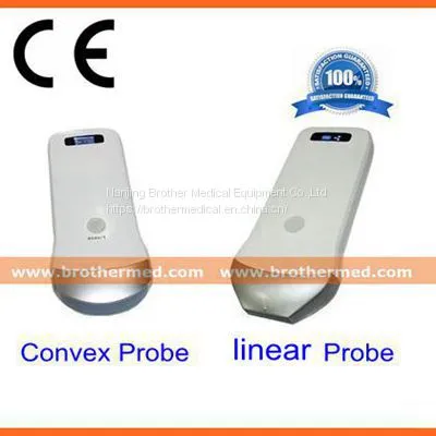 Wireless Ultrasound Scanner With Convex Probe or Linear Probe