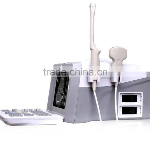 Portable Ultrasound Scanner Price, Hospital Full-digital Laptop 2018CI photo-2