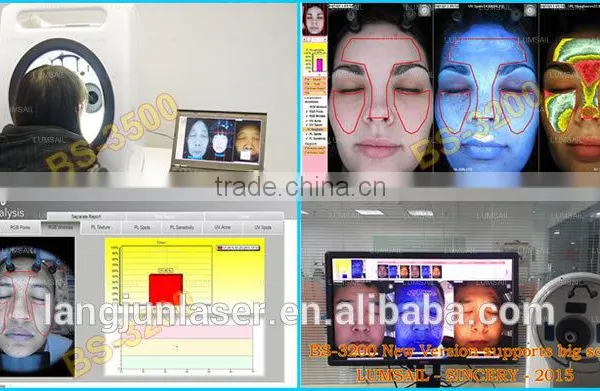 2016 Latest Amazing Magic Skin Analyzer, Skin Scope Analyzer photo-3
