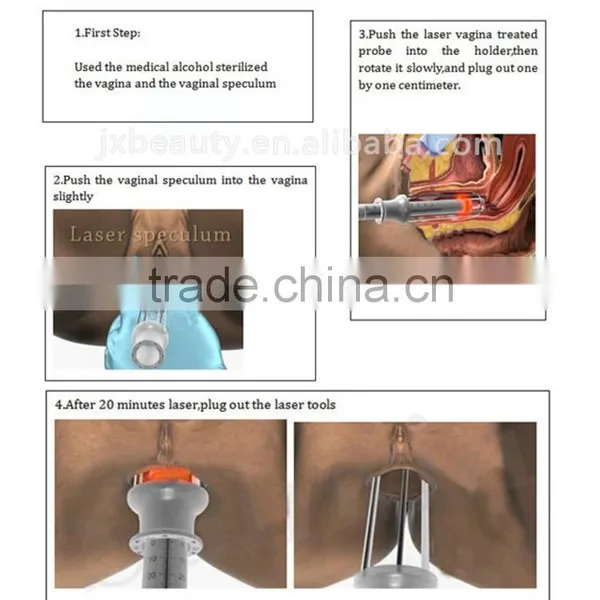 Fractional Laser for Skin Rejuvenation & Skin Tightening Laser Machine photo-4