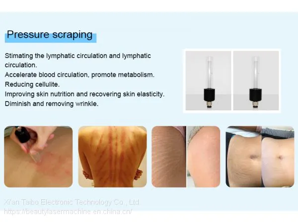 Day Spa Vacuum Striation Crack Treatment Strech Mark Removal Machine for Sale /vacuum Body Massger photo-4