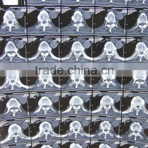 Imaging Medical Ray Film,digital X-ray Cr,fuji X-ray Film Sale From Factory