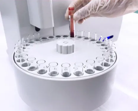 Electrolyte Analyzer photo-2