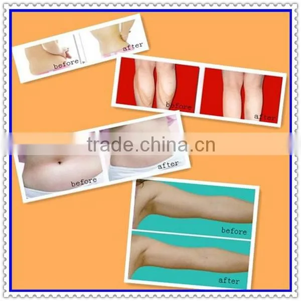 650nm Diode Laser Weight Loss Machine AF-S57 photo-4