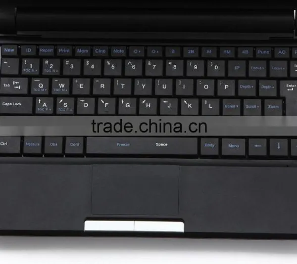 Lower Price Mini Laptop Medical Diagnose Ultrasound Scanner Machine-abdominal, Cardiac, Obstetrics, Gynecology photo-4