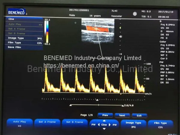 Popular Portable Color Doppler Ultrasound Scanner Bene-3 photo-5