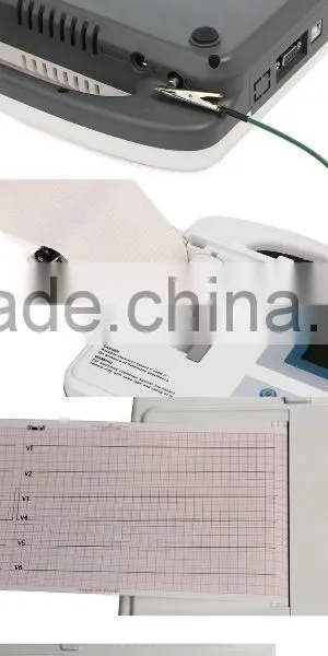 Hot Selling Six Channel Digital 12 Leads ECG Machine, Electrocardiograph, Portable ECG Monitor photo-5