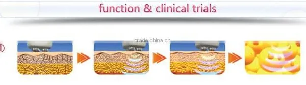 Lift rf Skin Forming Tightening Face Beauty Machine Portable photo-5