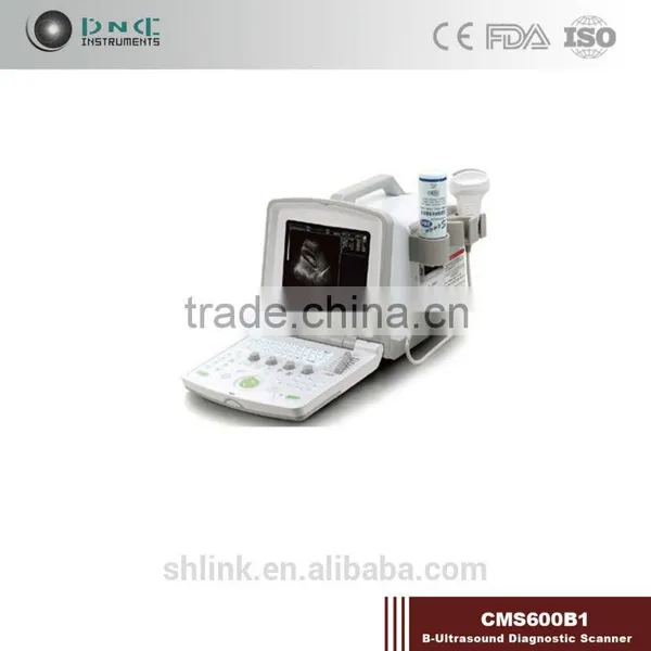 Medical Chinese B-Ultrasound Diagnostic Scanner CMD600B1 Ultrasound Scanner