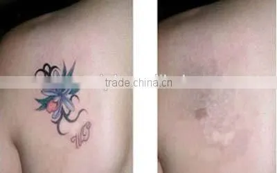 Easier Carry 10KG Nd Yag Laser for Tattoo Removal Machine to Remove Eyebrow, Eyelip and Wash Colors in Charcoal Carbon q Switch photo-6