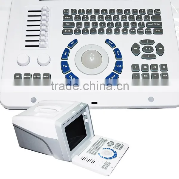 CE & FDA Approved Digital Portable Ultrasound Scanner Price photo-5