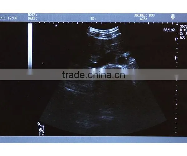 China Medical 6.5MHz Rectal Linear Probe 3.5MHz Convex Probe Portable Laptop Animal Ultrasound Machine photo-6