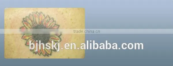 Fda Approval Nd:yag Laser Hair Removal Device/tattoo for Removal photo-2
