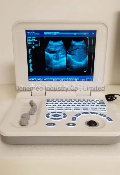 Notebook Type Black and White Ultrasound Scanner Medical Equipment photo-3