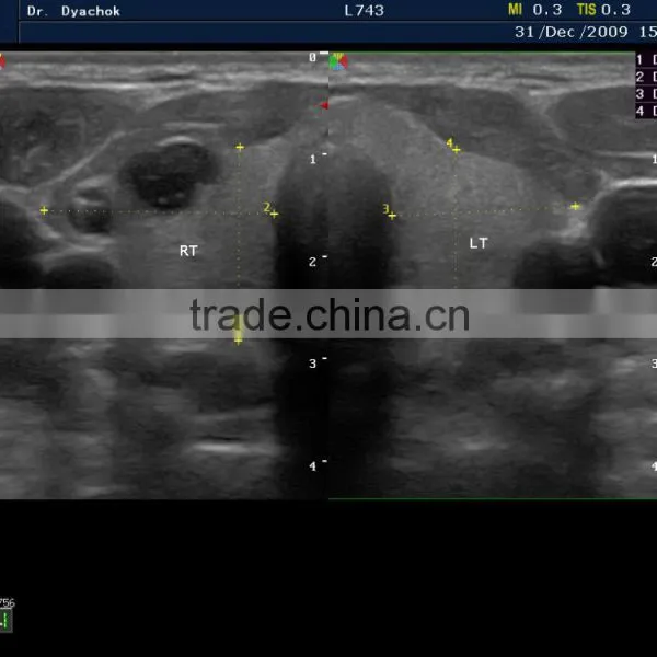 MC-DU-S8EXP Echocardiography Color Doppler Ultrasound Scanner photo-5