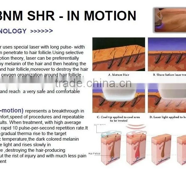 HOT!!!Vertical 808nm Diode Laser Hair Removal Beauty Equipment&machine photo-4