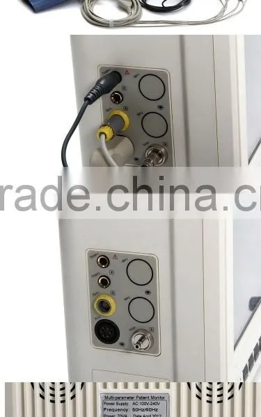Economic Price New Medical Device 8-inch Portable Multiparameter Patient Monitor for Hospital photo-5