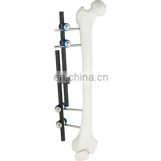 Orthopedic Surgical Instruments Femur&Tibial External Fixator for Femur&Tibia Surgery photo-6
