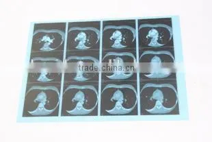 Fuji DI-HL Dry Laser Imaging Film Fuji Film Agfa photo-5